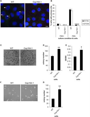 CEP164 Deficiency Causes Hyperproliferation of <mark class="highlighted">Pancreatic Cancer Cells</mark>